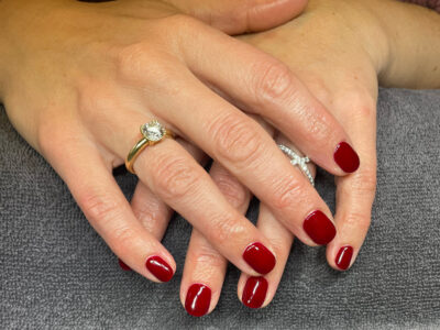 Shellac-Louise-Fuhlendorff---Kosmetisk-Klinik-Aarhus-(3)